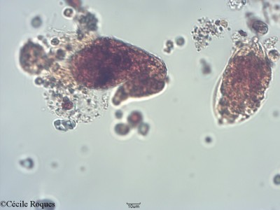 protozoo/Tontonia sp.(1)(copy)_thumb.jpg